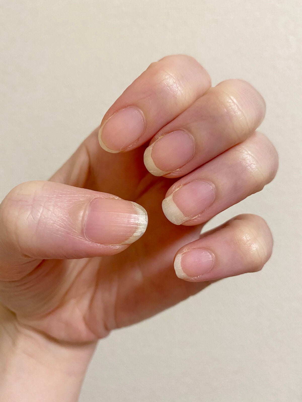 キューティクルペン/enieni /ネイルオイル・トリートメントを使ったクチコミ(4枚目)