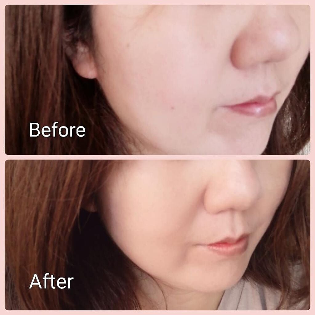 スポットイレイサーコンシーラーペンシル/MustaeV/ペンシルコンシーラーを使ったクチコミ(5枚目)