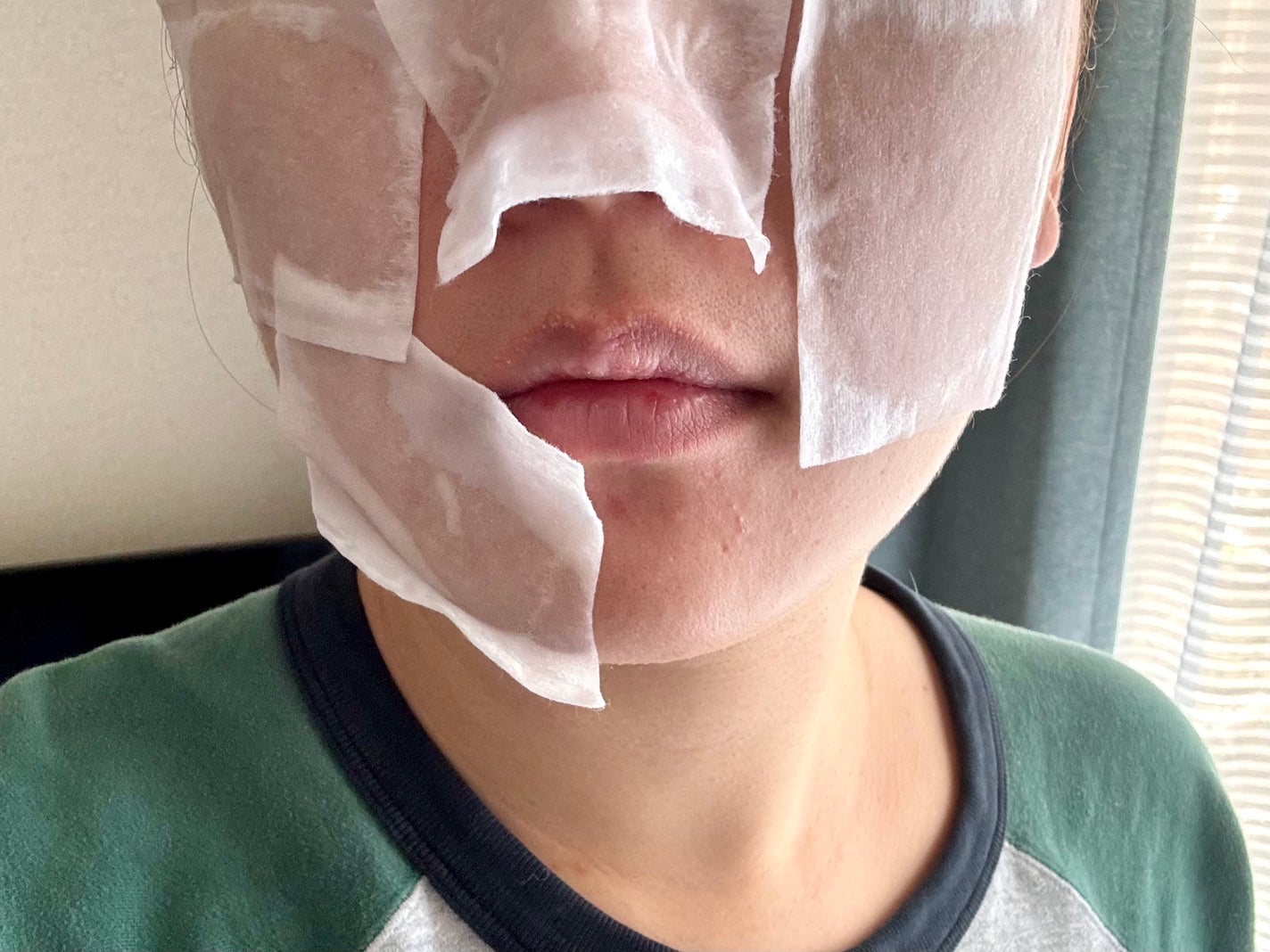 オードムーゲ 薬用ローション(ふきとり化粧水)/オードムーゲ/拭き取り化粧水を使ったクチコミ(3枚目)