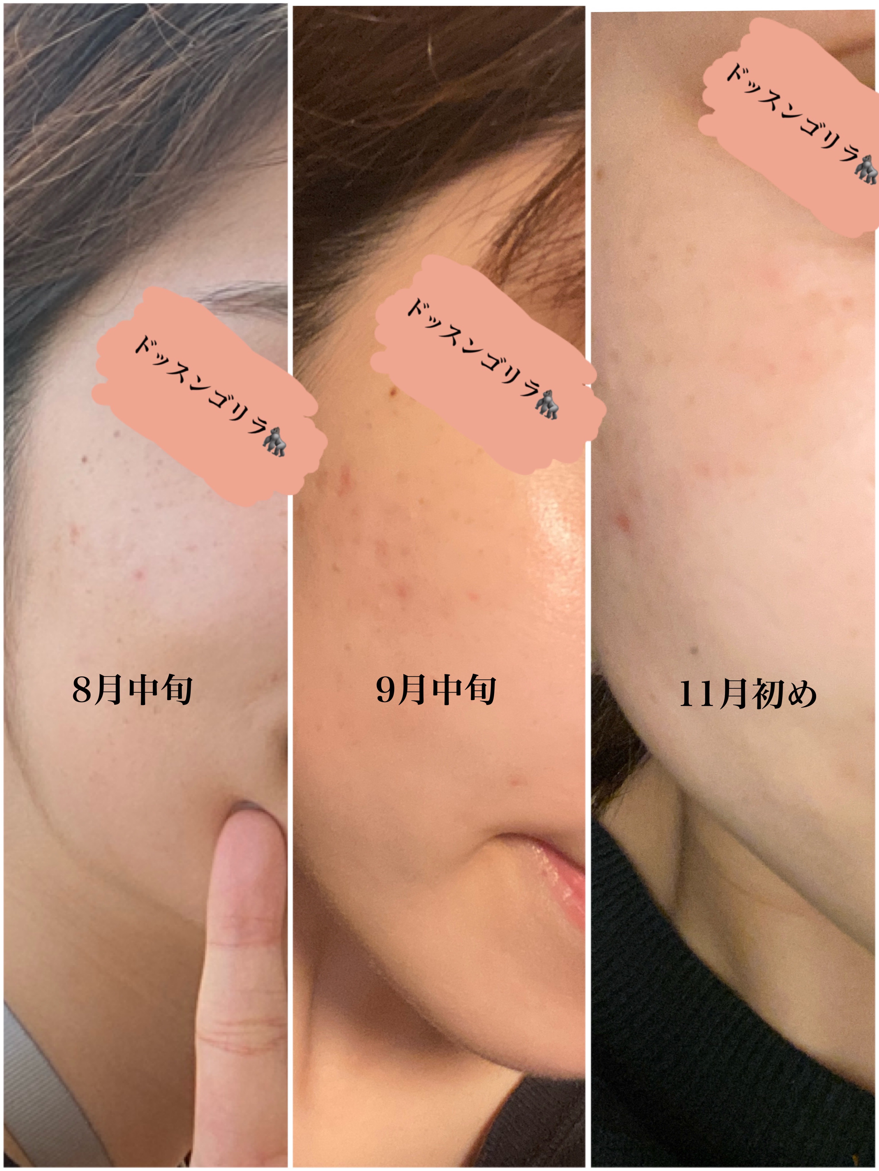 リンクルアイクリーム N/なめらか本舗/アイケア・アイクリームを使ったクチコミ（2枚目）