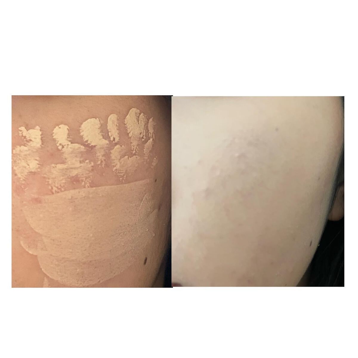 マスクフィットオールカバーデュアルコンシーラー/TIRTIR(ティルティル)/コンシーラーを使ったクチコミ（3枚目）