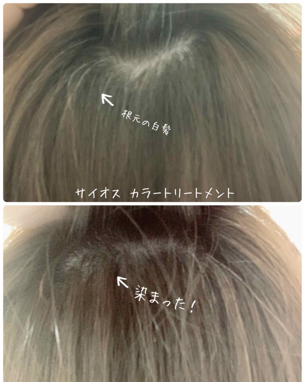 カラートリートメント/サイオス/ヘアカラーを使ったクチコミ(3枚目)