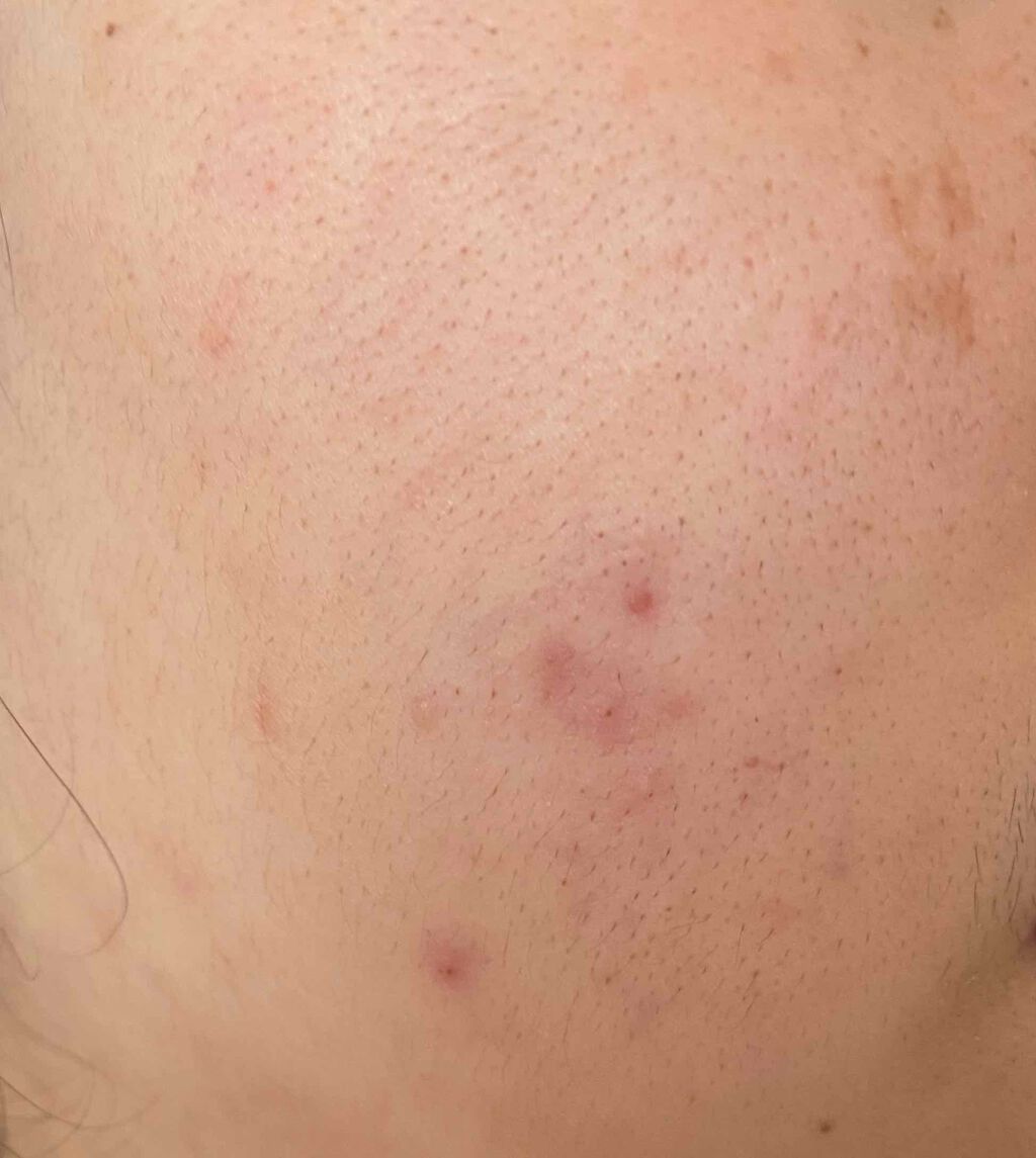 UHAグミサプリ ビタミンC/UHA味覚糖/食品を使ったクチコミ（2枚目）