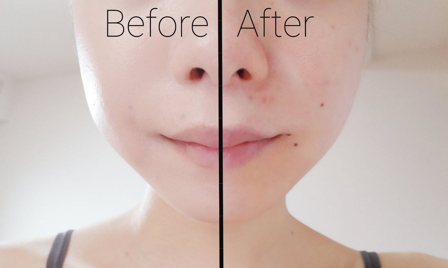 ピンクティーツリーカバーアップグロウクッション/APLIN/クッションファンデーションを使ったクチコミ(4枚目)