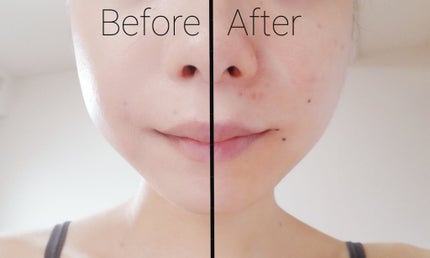 ピンクティーツリーカバーアップグロウクッション/APLIN/クッションファンデーションを使ったクチコミ(4枚目)