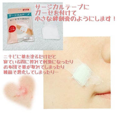 ヨナ on LIPS 「テープで保護！✨　【ニキビを早く治す方法】ニキビが長引くのは気..」（2枚目）