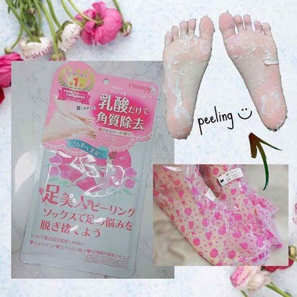ミメオ ピーリングソックス/Miimeow(ミメオ)/レッグ・フットケアを使ったクチコミ(1枚目)
