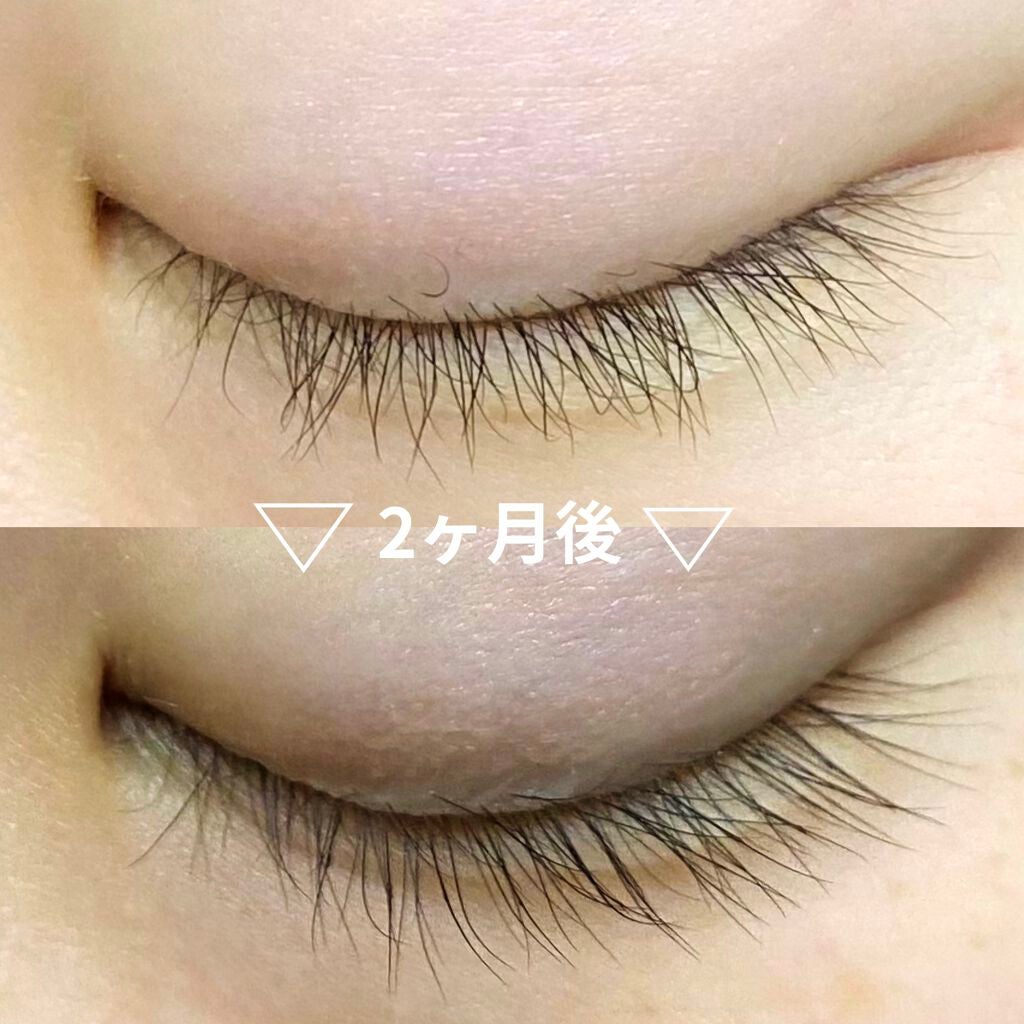 ローヤルゼリー配合 栄養ローション/DAISO/美容液を使ったクチコミ(1枚目)