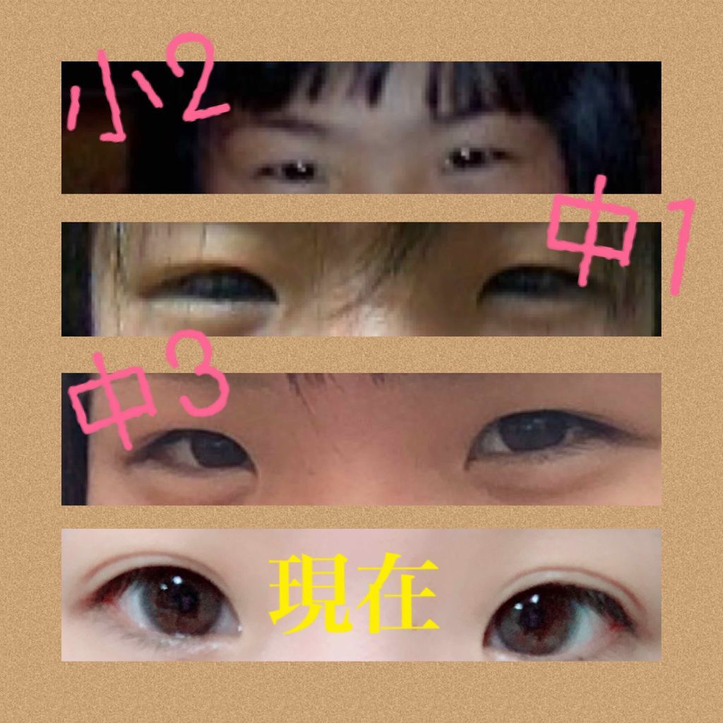 アイビューティー フィクサー WP/アストレア ヴィルゴ/二重まぶた用アイテムを使ったクチコミ(2枚目)