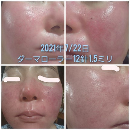 CICA デイリースージングマスク/VT/シートマスク・パックを使ったクチコミ(5枚目)