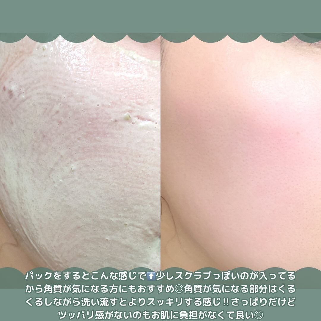 プレミアムもちソープ「グリーンアルティザン」/アレンシア/その他洗顔料を使ったクチコミ(5枚目)