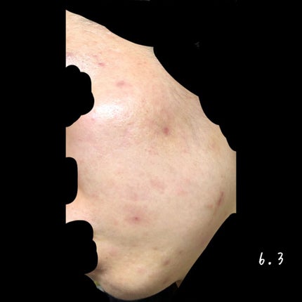 を使ったクチコミ(1枚目)