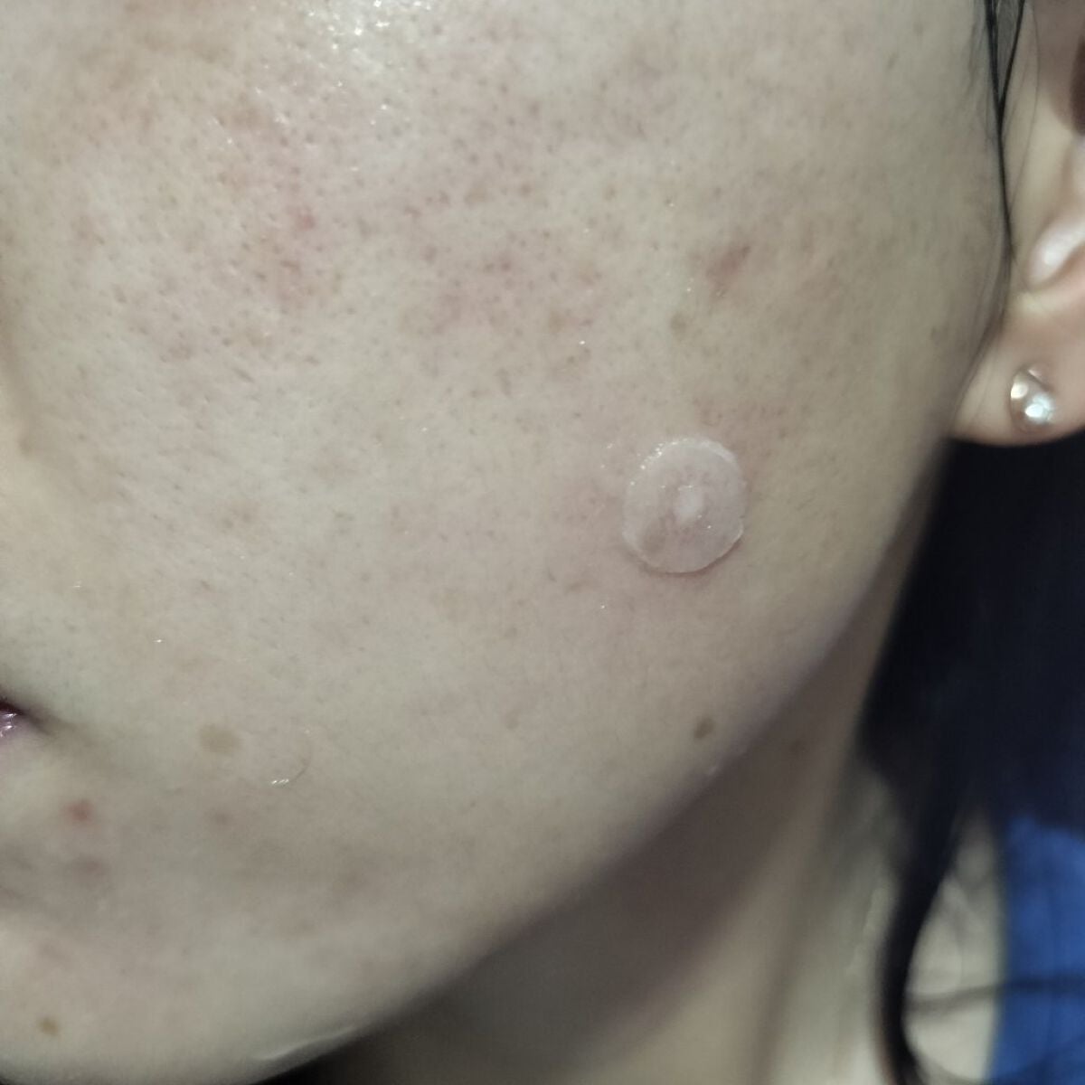 miina@汚肌工事録⚠️ on LIPS 「10/26#汚肌工事録ありがとう💕/#毎日運動短いから続けられ..」(2枚目)