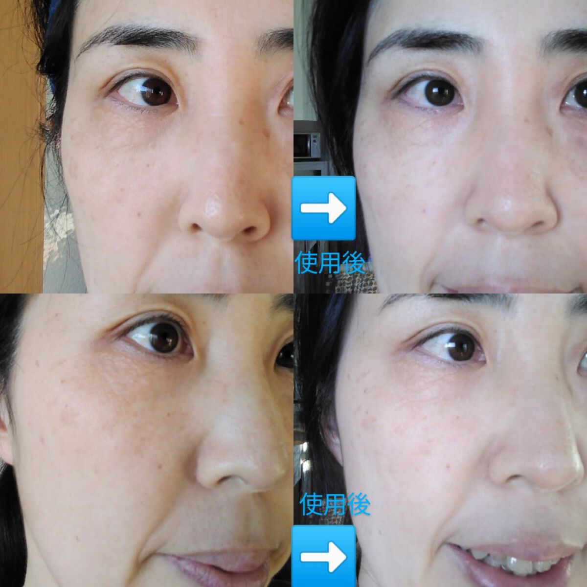 プラケアEQフェイスマスク/LUNAS (ルーナス)/シートマスク・パックを使ったクチコミ(3枚目)