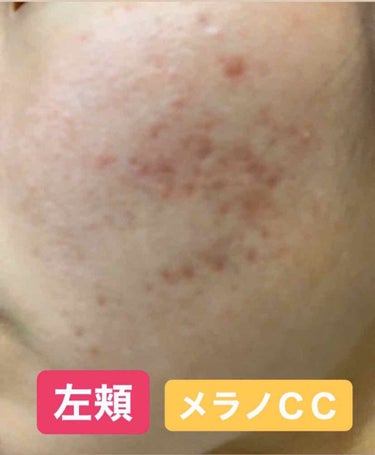 敏感肌用薬用美白美容液/無印良品/美容液を使ったクチコミ（3枚目）