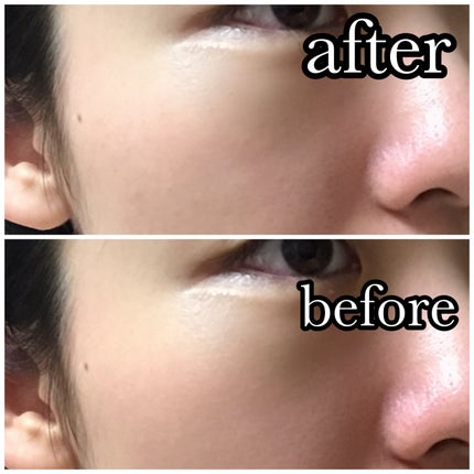 サウンド リニューアル セラムクリーム/SUPEREGG /フェイスクリームを使ったクチコミ(5枚目)