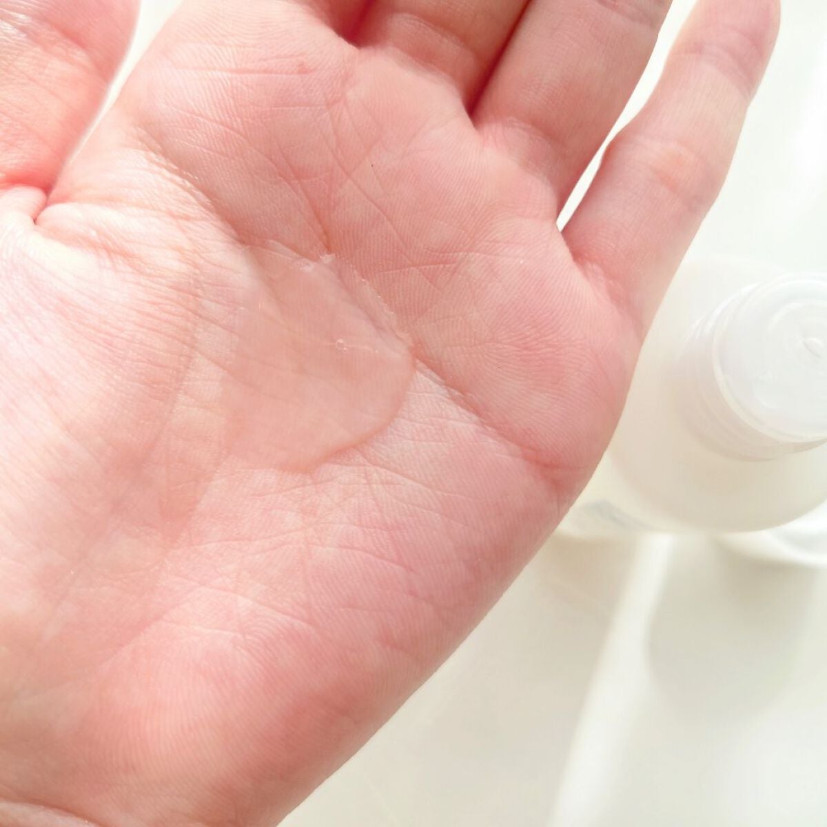 アカルミー化粧水/ワイズ/化粧水を使ったクチコミ(3枚目)