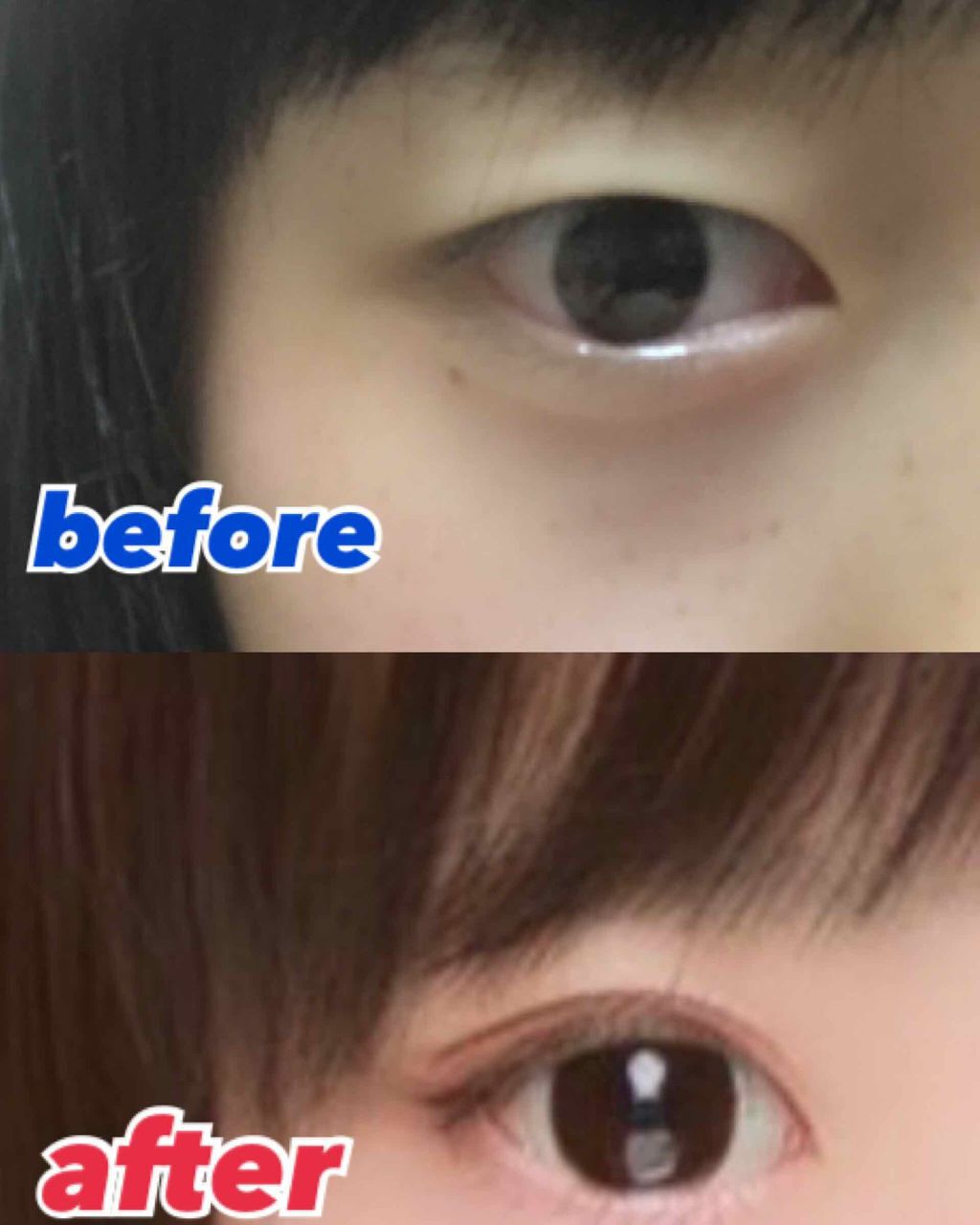 オペラアイプチS/OPERA/二重まぶた用アイテムを使ったクチコミ（3枚目）