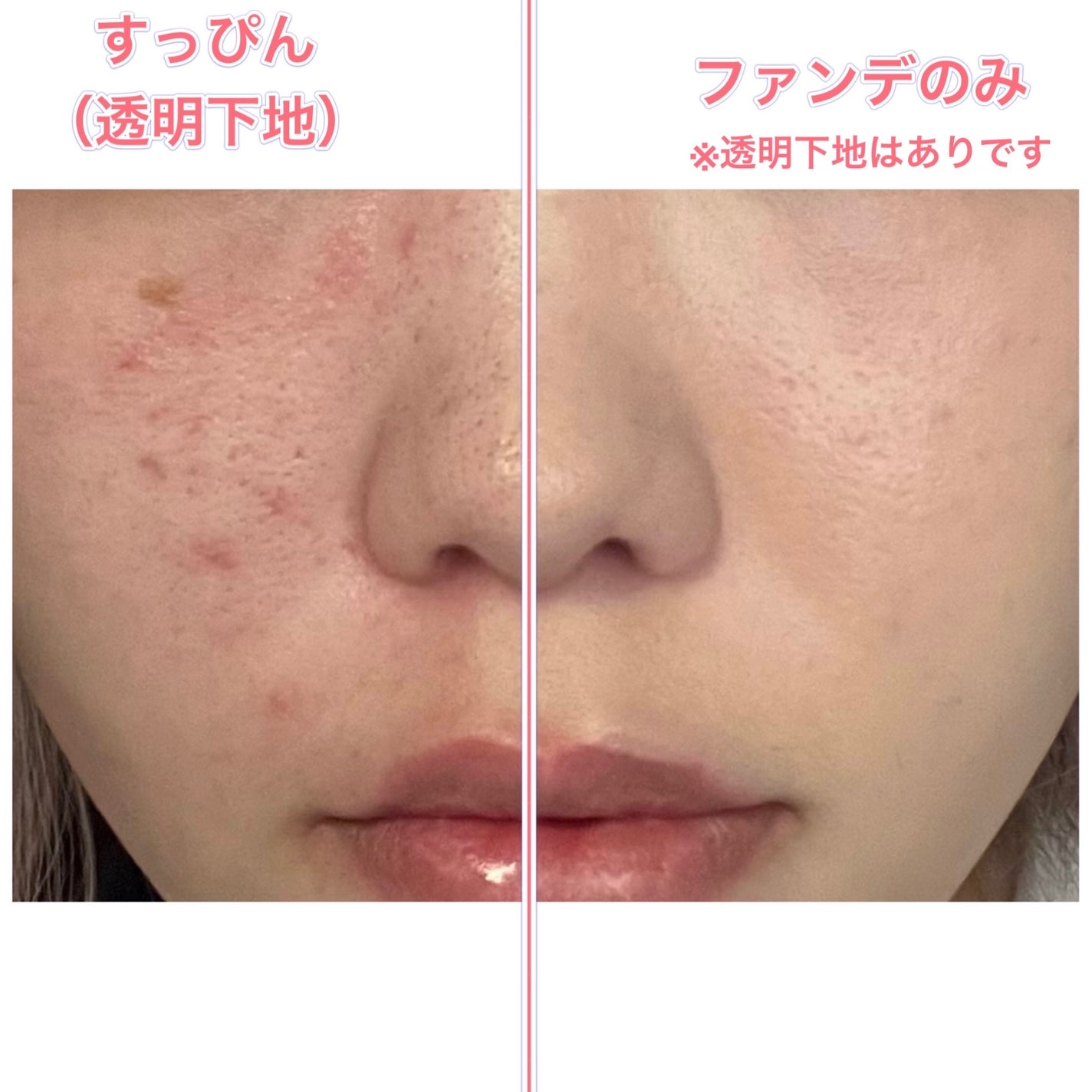 ãã« ã«ã㌠ãã¡ã³ãŠã§ã¢ ã¯ãã·ã§ã³ ã¶ ãªãªãžãã«/CLIO/ã¯ãã·ã§ã³ãã¡ã³ããŒã·ã§ã³ã䜿ã£ãã¯ãã³ãïŒ2æç®ïŒ