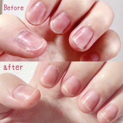 ディープセラム/Dr.Nail/ネイルオイル・トリートメントを使ったクチコミ(2枚目)