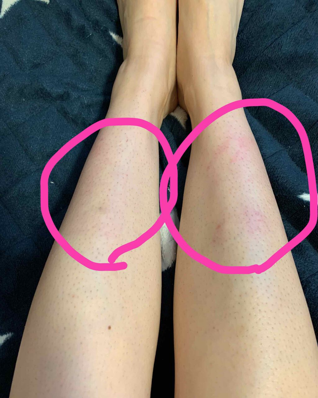 脱毛ワックスシート 敏感肌用/Veet/除毛クリームを使ったクチコミ（2枚目）