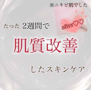 キュレル 潤浸保湿 フェイスクリームのクチコミ「【ニキビ肌>>肌質改善ニキビゼロ💯】



🐥商品🐥
・肌ラボモイスト化粧水c
・Curel .....」（1枚目）