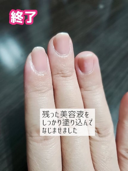 ゆびさき&ネイルケアパック/DAISO/ネイル用品を使ったクチコミ(6枚目)