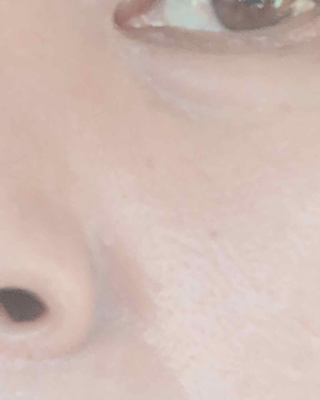 LA10+HAフェイスセラム/The Ordinary/ピーリングを使ったクチコミ（3枚目）