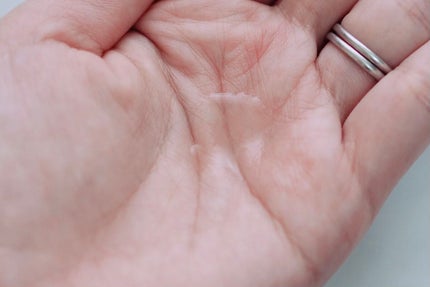 アクネケア ジェル乳液 <医薬部外品>/ファンケル/乳液を使ったクチコミ(4枚目)