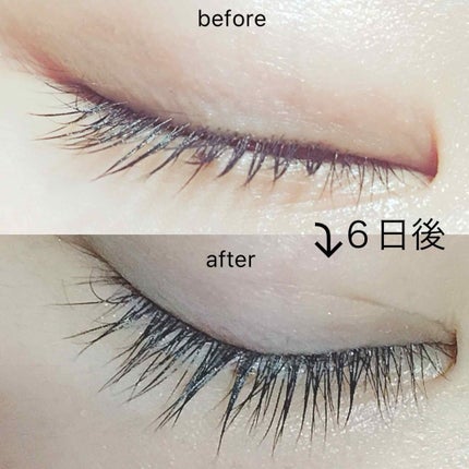 ローヤルゼリー配合 栄養ローション/DAISO/美容液を使ったクチコミ(1枚目)