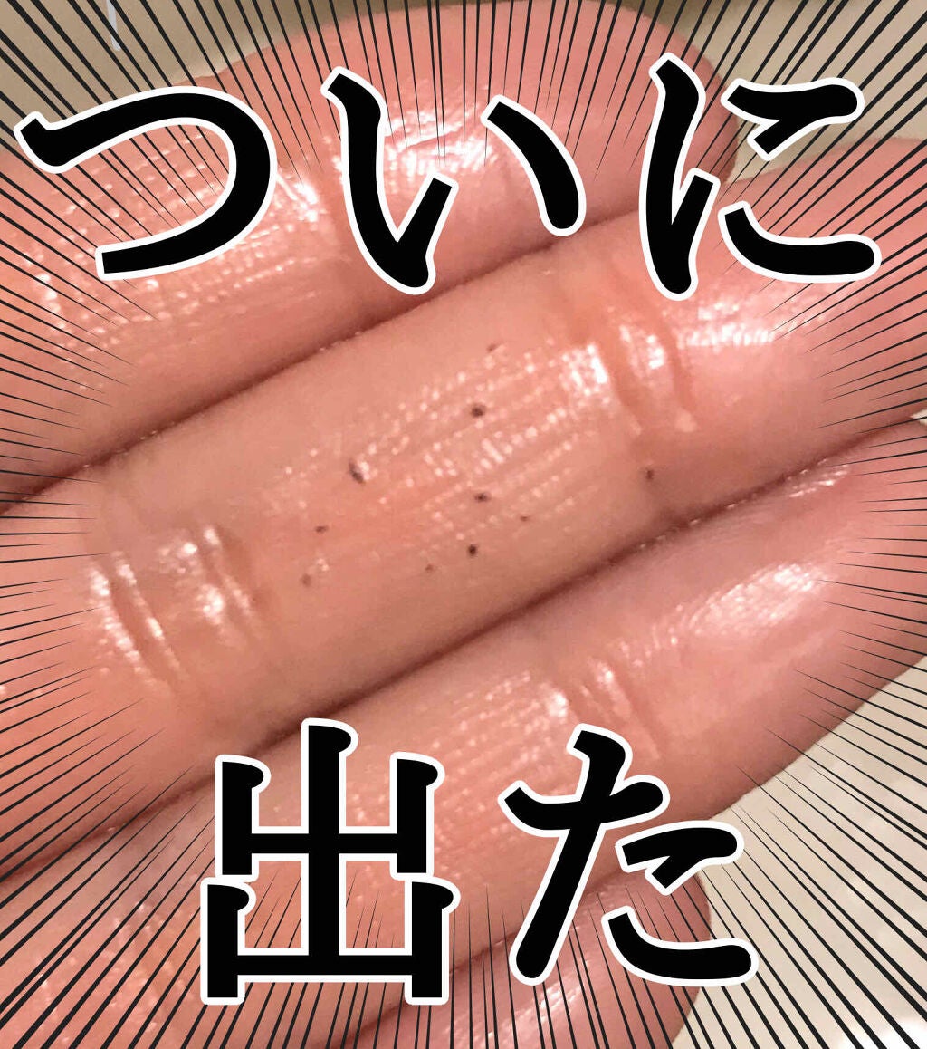 アバサ タマヌオイル/アイランドエッセンス/フェイスオイルを使ったクチコミ(1枚目)