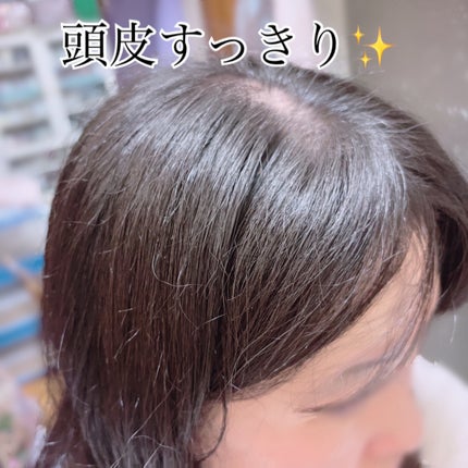 スパークリングスカルプスケーラー/ミンツリー/頭皮ケアを使ったクチコミ(8枚目)