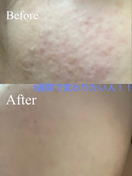 を使ったクチコミ(1枚目)