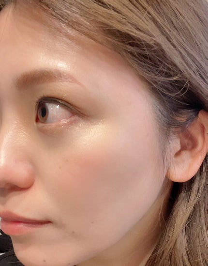 ソフィーナ iP ブライトニング美容液/SOFINA iP/美容液を使ったクチコミ(6枚目)