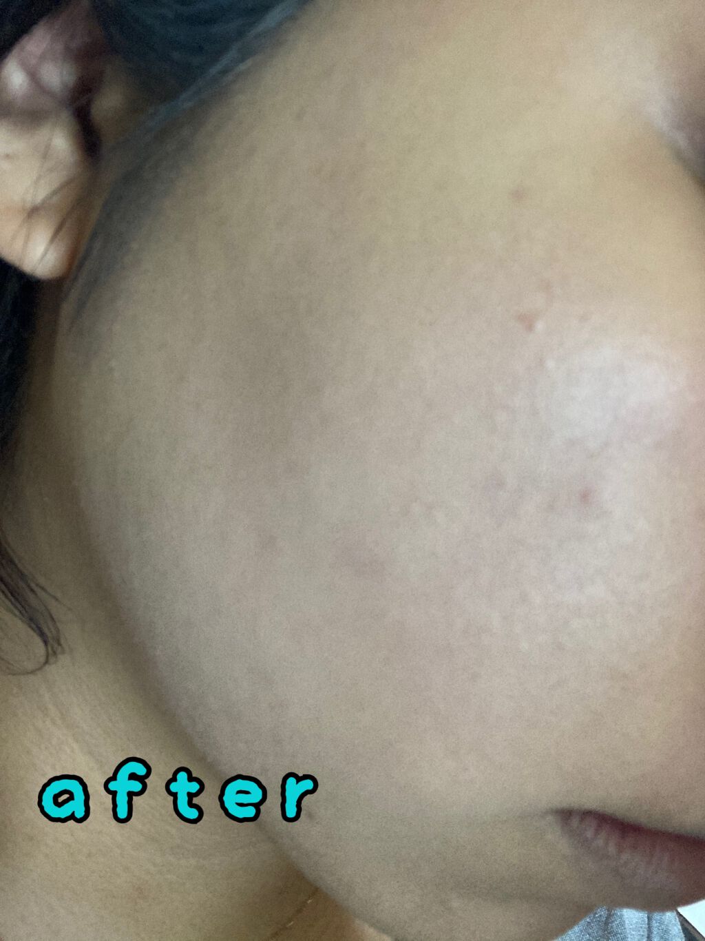 フィットミー リキッドファンデーション R/MAYBELLINE NEW YORK/リキッドファンデーションを使ったクチコミ（3枚目）