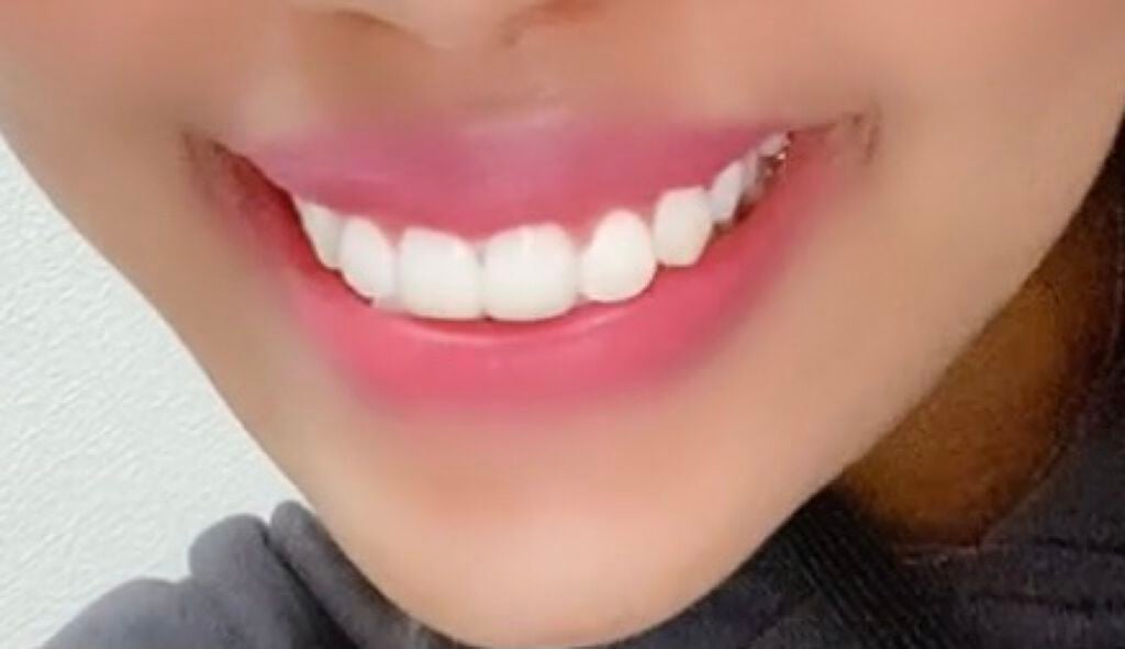 コンクールF/ウエルテック/マウスウォッシュ・スプレーを使ったクチコミ(2枚目)