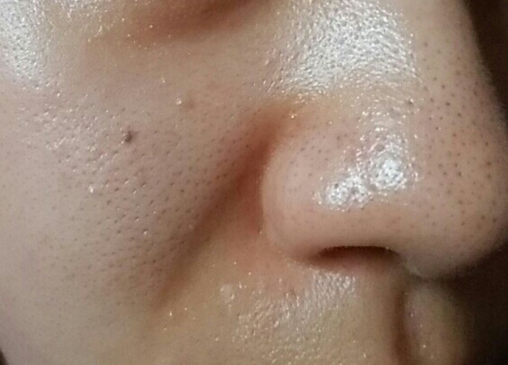 xxx on LIPS 「【ガスール洗顔チャレンジ】四日目にして方針を変えます!←今まで..」(2枚目)