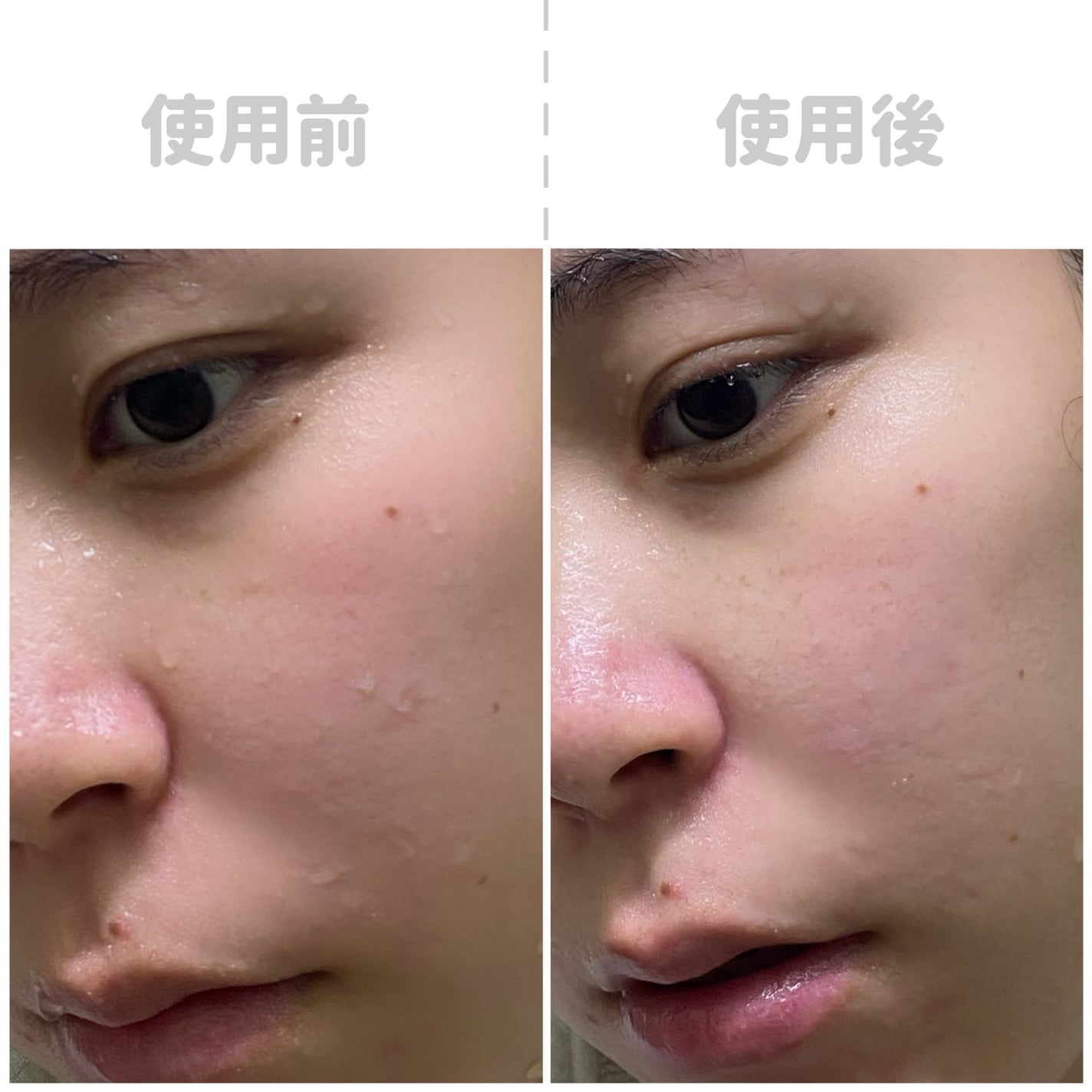 ブライトニングピーリングジェル/Dr.G/ピーリングを使ったクチコミ(2枚目)