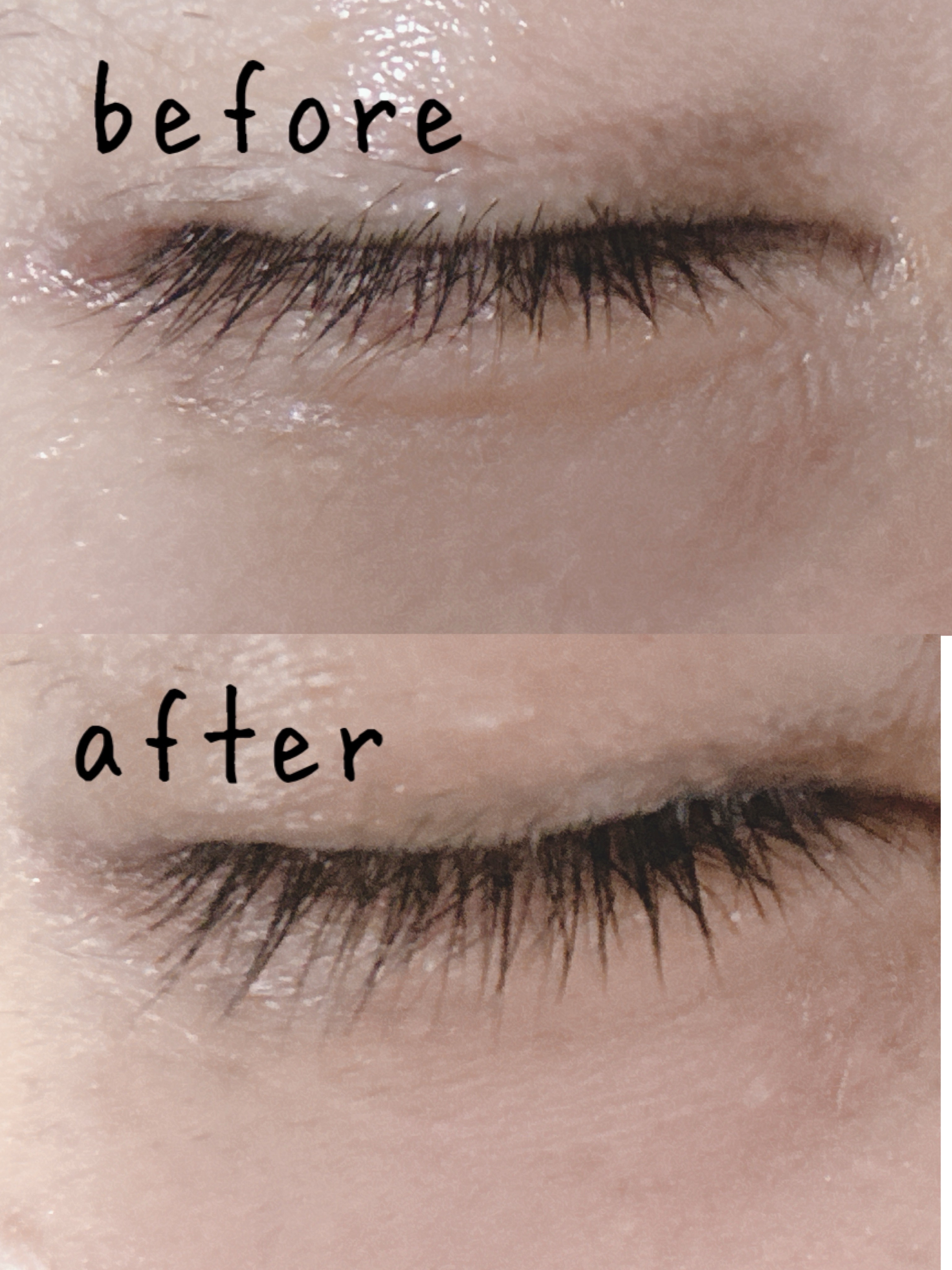 目元ケア美顔器/and us/美顔器・マッサージを使ったクチコミ（2枚目）