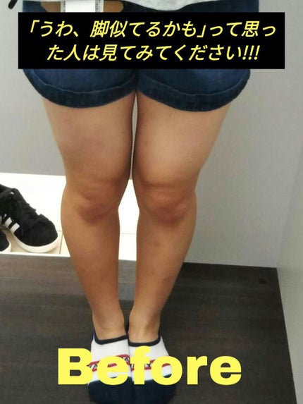 ハトムギ化粧水(ナチュリエ スキンコンディショナー R )/ナチュリエ/化粧水を使ったクチコミ(1枚目)