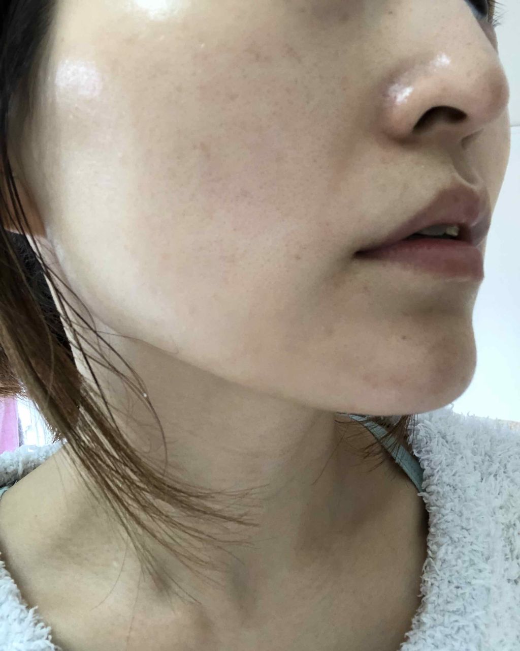 薬用ホワイトレディ/HABA/美容液を使ったクチコミ(1枚目)