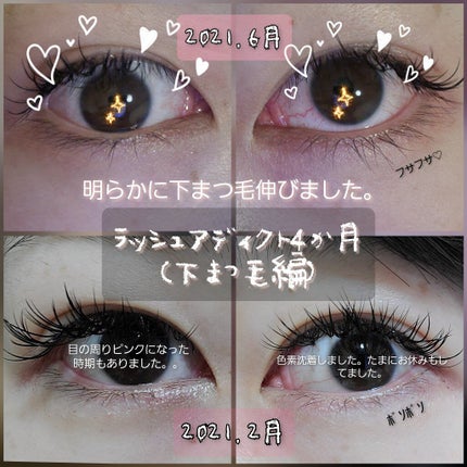 ラッシュアディクト アイラッシュコンディショニングセラム/soaddicted/まつげ美容液を使ったクチコミ(1枚目)