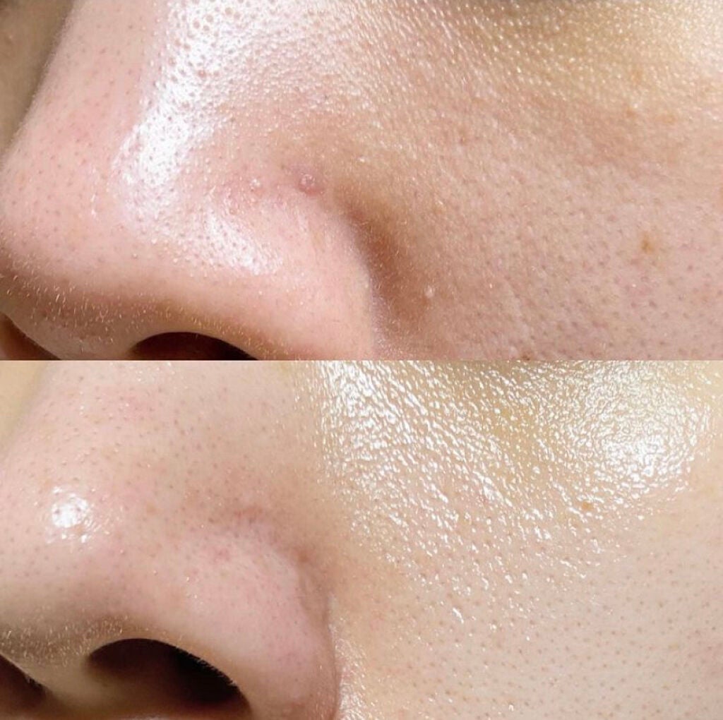 エンリッチCセラム/IGA LAB/美容液を使ったクチコミ(10枚目)