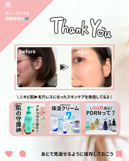 ゼロ毛穴1DAYセラム/MEDICUBE/美容液を使ったクチコミ(10枚目)