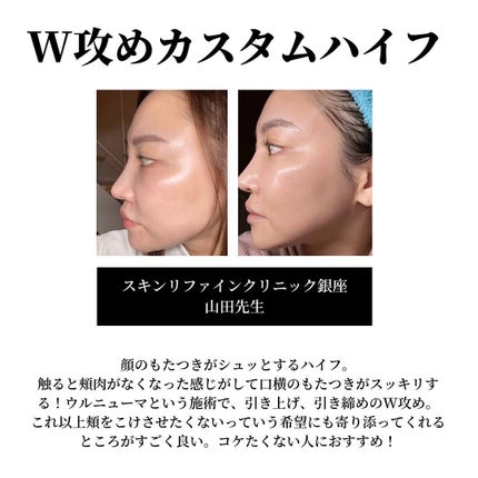 miriïŒã¿ãïŒðŒ on LIPS ãä»å¹Žãã£ãŠè¯ãã£ãçŸå®¹å»çïŒãããããšãäžè©±ã«ãªããŸããðå³..ãïŒ5æç®ïŒ