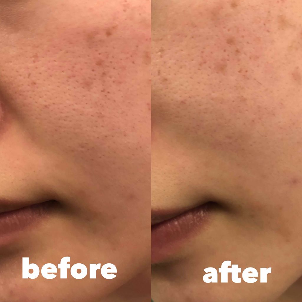 ジェムミラクル ブラックパール O2バブルマスク/the SAEM/洗い流すパック・マスクを使ったクチコミ(4枚目)