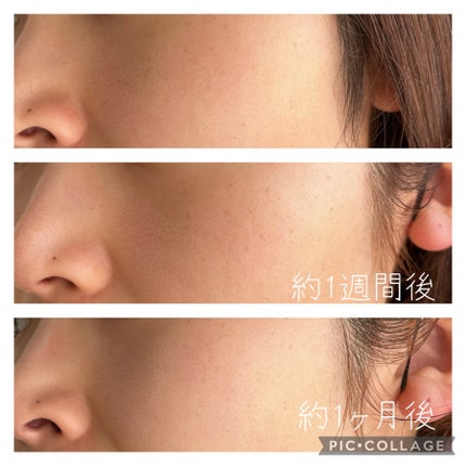 アリウル グリーンビタミンC トーニングセラム(アンプル)/Ariul/美容液を使ったクチコミ(3枚目)