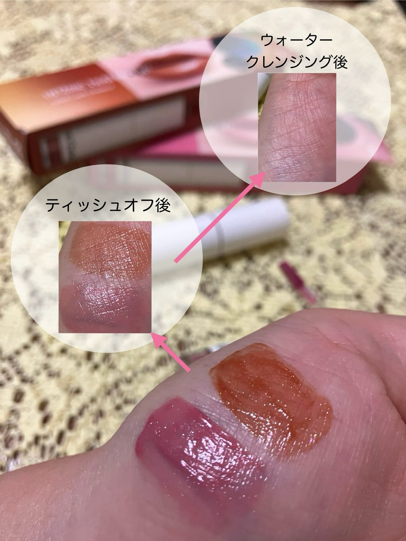 ã¢ãããã¥ãŒããŒããã°ãã€ãªãããã«ã©ãŒããã¯ãã©ã³ããŒ/up2me/ãªãããã©ã³ããŒã䜿ã£ãã¯ãã³ãïŒ2æç®ïŒ