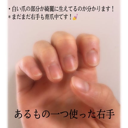 オリジナル ピュアスキンジェリー/ヴァセリン/ボディクリームを使ったクチコミ(2枚目)