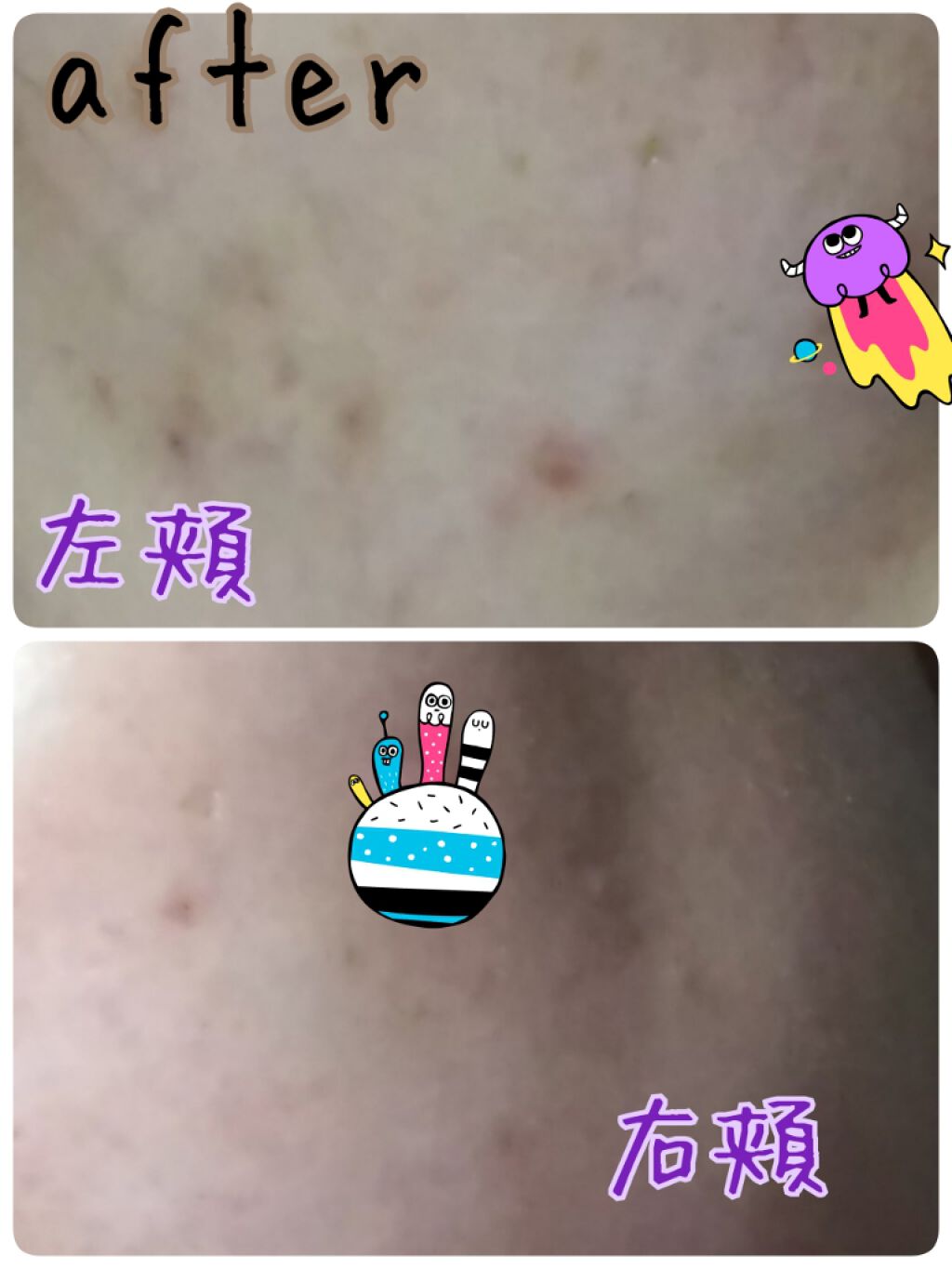 DHC ビタミンBミックス/DHC/美容サプリメントを使ったクチコミ（3枚目）